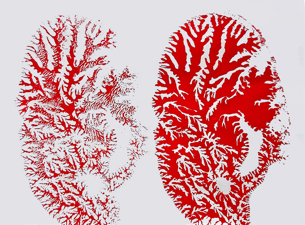 N.Machoń%20monotypia5 kopia